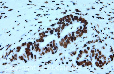 Immunohistochemistry (Formalin/PFA-fixed paraffin-embedded sections) - Anti-Histone H3 (acetyl K9) antibody - ChIP Grade (AB10812)