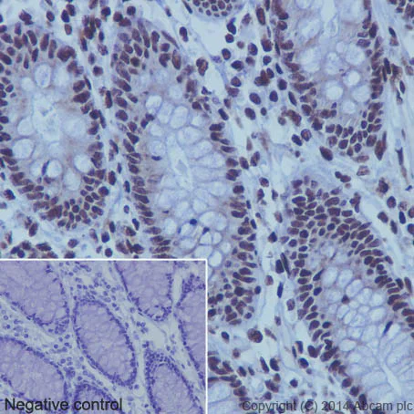 Immunohistochemistry (Formalin/PFA-fixed paraffin-embedded sections) - Anti-Histone H3 (acetyl K9) antibody [EPR16988] - ChIP Grade (AB177177)