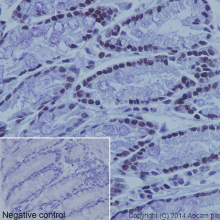 Immunohistochemistry (Formalin/PFA-fixed paraffin-embedded sections) - Anti-Histone H3 (acetyl K9) antibody [EPR16988] - ChIP Grade (AB177177)
