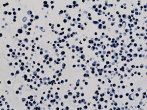 Immunocytochemistry - Anti-Histone H3 (acetyl K9) antibody [RM161] (AB218553)