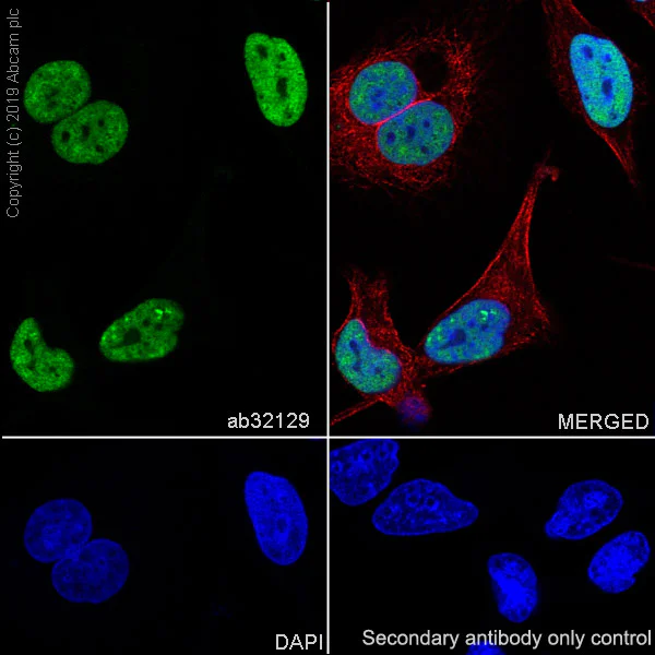Immunocytochemistry/ Immunofluorescence - Anti-Histone H3 (acetyl K9) antibody [Y28] - ChIP Grade - BSA and Azide free (AB203951)
