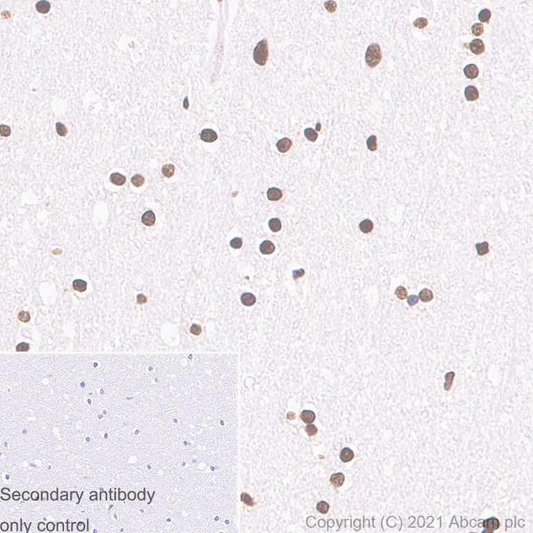 Immunohistochemistry (Formalin/PFA-fixed paraffin-embedded sections) - Anti-Histone H3 (acetyl K9) antibody [Y28] - ChIP Grade - BSA and Azide free (AB203951)