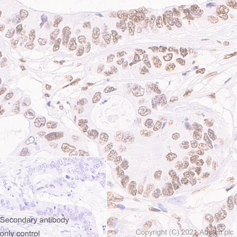 Immunohistochemistry (Formalin/PFA-fixed paraffin-embedded sections) - Anti-Histone H3 (acetyl K9) antibody [Y28] - ChIP Grade - BSA and Azide free (AB203951)