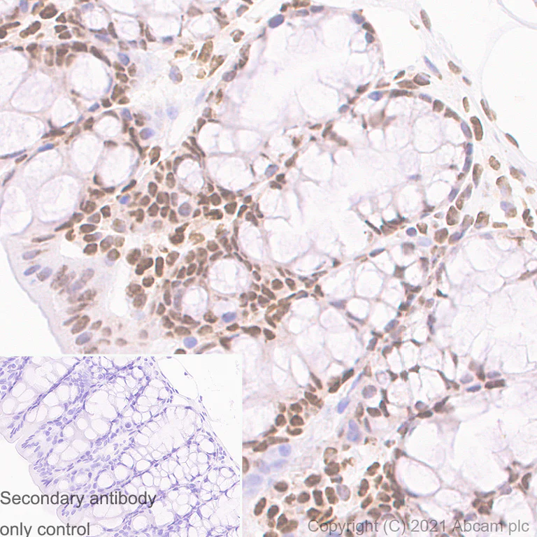 Immunohistochemistry (Formalin/PFA-fixed paraffin-embedded sections) - Anti-Histone H3 (acetyl K9) antibody [Y28] - ChIP Grade - BSA and Azide free (AB203951)