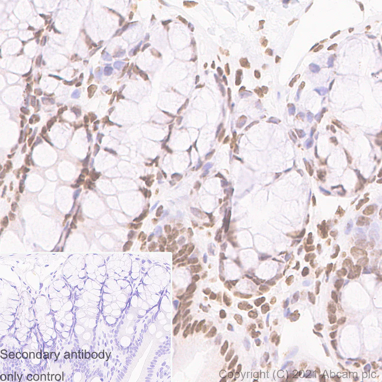 Immunohistochemistry (Formalin/PFA-fixed paraffin-embedded sections) - Anti-Histone H3 (acetyl K9) antibody [Y28] - ChIP Grade - BSA and Azide free (AB203951)