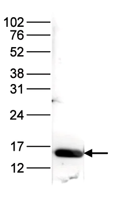 Western blot - Anti-Histone H3 (acetyl K9 + K14) antibody (AB232952)