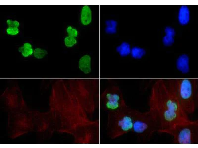 Immunocytochemistry/ Immunofluorescence - Anti-Histone H3 (acetyl K9 + K14) antibody (AB272151)