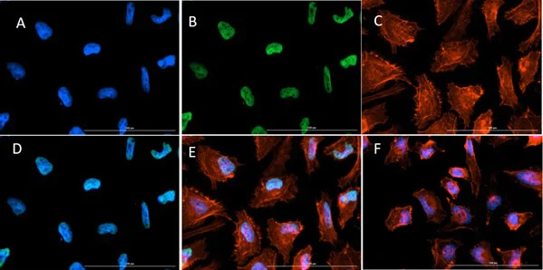 Immunocytochemistry/ Immunofluorescence - Anti-Histone H3 (acetyl K9 + K14) antibody (AB272151)