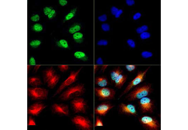 Immunocytochemistry/ Immunofluorescence - Anti-Histone H3 (acetyl K9, phospho S10) antibody (AB272166), expandable thumbnail