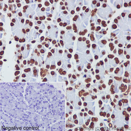 Immunohistochemistry (Formalin/PFA-fixed paraffin-embedded sections) - Anti-Histone H3 antibody [EPR16987] - Nuclear Marker and ChIP Grade (ab176842), expandable thumbnail
