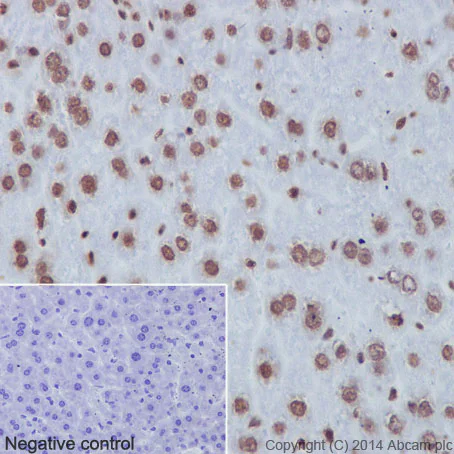Immunohistochemistry (Formalin/PFA-fixed paraffin-embedded sections) - Anti-Histone H3 antibody [EPR16987] - Nuclear Marker and ChIP Grade (AB176842)