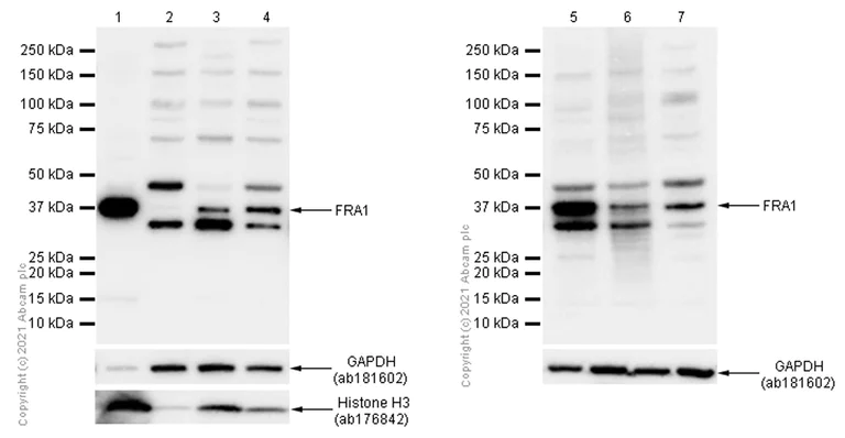 Western blot - Anti-Histone H3 antibody [EPR16987] - Nuclear Marker and ChIP Grade (AB176842)