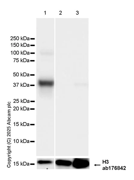 Western blot - Anti-Histone H3 antibody [EPR16987] - Nuclear Marker and ChIP Grade (AB176842)
