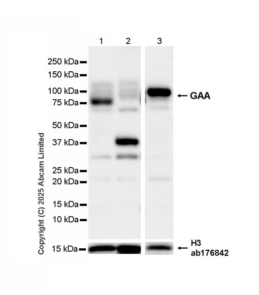 Western blot - Anti-Histone H3 antibody [EPR16987] - Nuclear Marker and ChIP Grade (ab176842), expandable thumbnail