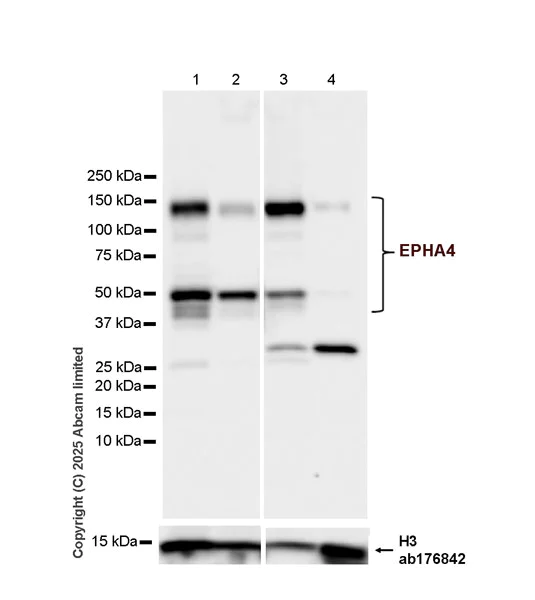 Western blot - Anti-Histone H3 antibody [EPR16987] - Nuclear Marker and ChIP Grade (AB176842)