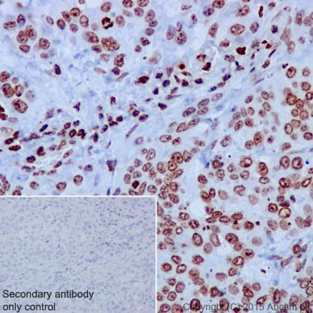 Immunohistochemistry (Formalin/PFA-fixed paraffin-embedded sections) - Anti-Histone H3 antibody [EPR17785] - BSA and Azide free (AB240361), expandable thumbnail