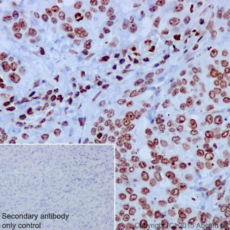 Immunohistochemistry (Formalin/PFA-fixed paraffin-embedded sections) - Anti-Histone H3 antibody [EPR17785] - Nuclear Marker (AB201456)