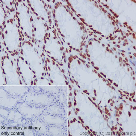Immunohistochemistry (Formalin/PFA-fixed paraffin-embedded sections) - Anti-Histone H3 antibody [EPR17785] - Nuclear Marker (AB201456)