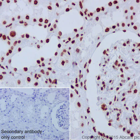 Immunohistochemistry (Formalin/PFA-fixed paraffin-embedded sections) - Anti-Histone H3 antibody [EPR17785] - Nuclear Marker (AB201456)