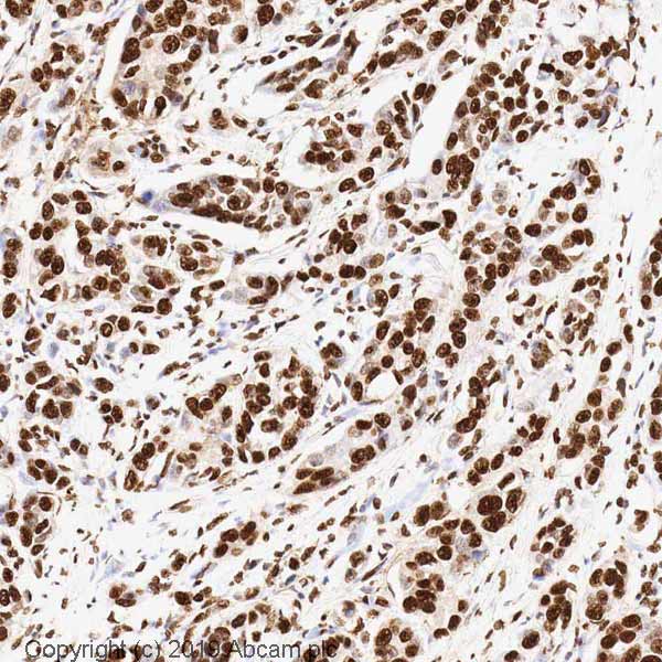 Immunohistochemistry (Formalin/PFA-fixed paraffin-embedded sections) - Anti-Histone H3 antibody [mAbcam 10799] - Nuclear Marker and ChIP Grade (ab10799), expandable thumbnail