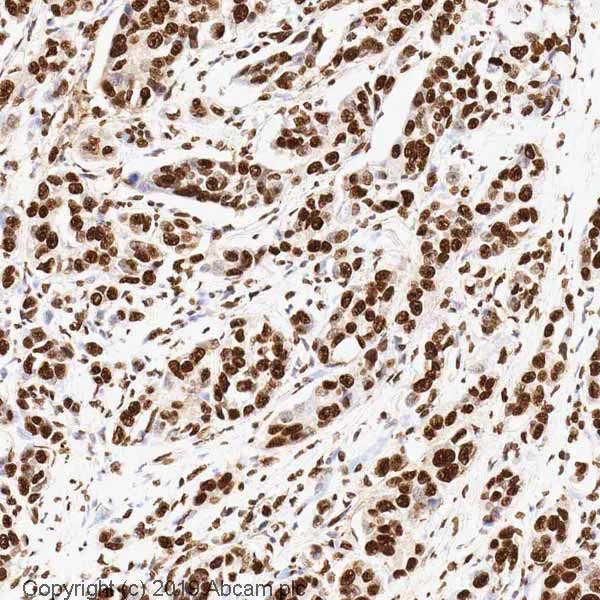 Immunohistochemistry (Formalin/PFA-fixed paraffin-embedded sections) - Anti-Histone H3 antibody [mAbcam 10799] - Nuclear Marker and ChIP Grade (AB10799)