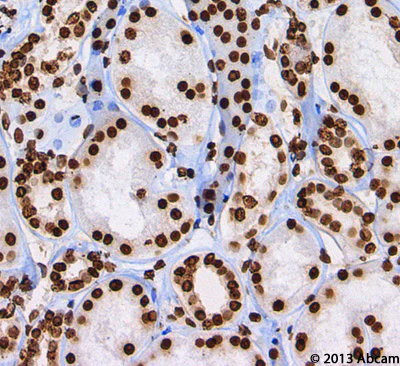 Immunohistochemistry (Formalin/PFA-fixed paraffin-embedded sections) - Anti-Histone H3 antibody [mAbcam 10799] - Nuclear Marker and ChIP Grade (AB10799)