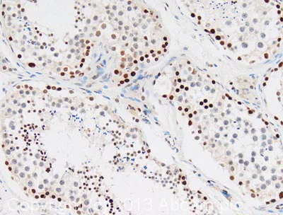 Immunohistochemistry (Formalin/PFA-fixed paraffin-embedded sections) - Anti-Histone H3 antibody - Nuclear Marker (AB18521)