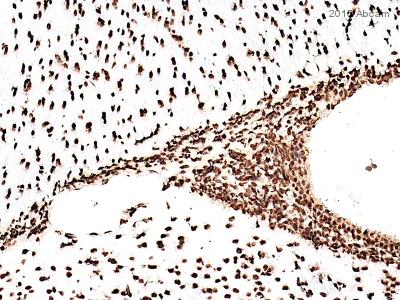 Immunohistochemistry (Formalin/PFA-fixed paraffin-embedded sections) - Anti-Histone H3 antibody - Nuclear Marker and ChIP Grade (AB1791)