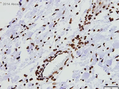 Immunohistochemistry (Formalin/PFA-fixed paraffin-embedded sections) - Anti-Histone H3 antibody - Nuclear Marker and ChIP Grade (AB1791)