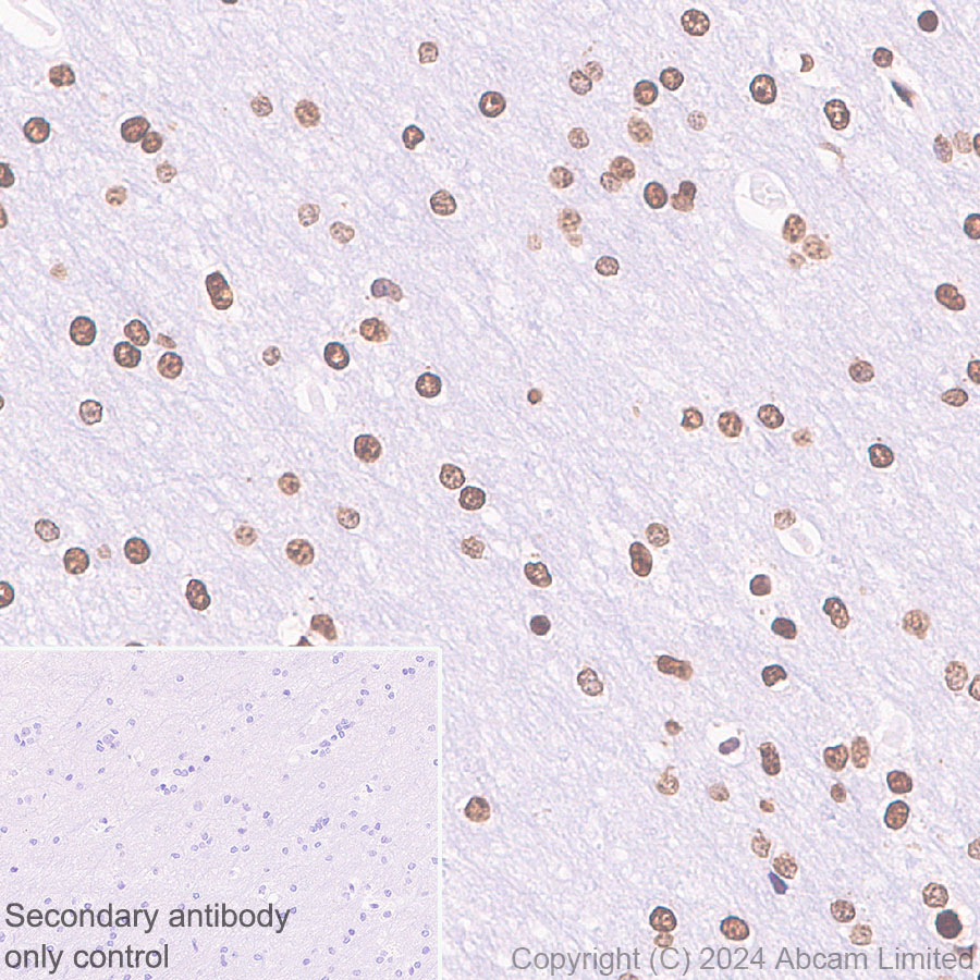 Immunohistochemistry (Formalin/PFA-fixed paraffin-embedded sections) - Anti-Histone H3 antibody [RM1288] (ab322707), expandable thumbnail