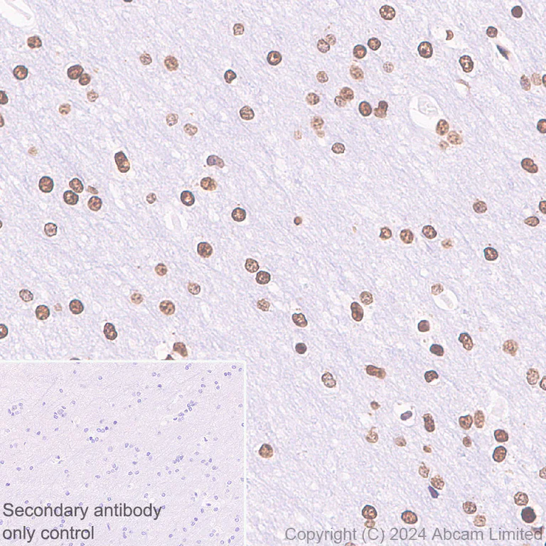 Immunohistochemistry (Formalin/PFA-fixed paraffin-embedded sections) - Anti-Histone H3 antibody [RM1288] - Nuclear Marker (AB322707)