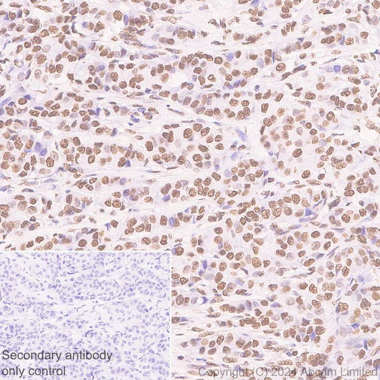 Immunohistochemistry (Formalin/PFA-fixed paraffin-embedded sections) - Anti-Histone H3 antibody [RM1288] - Nuclear Marker (AB322707)
