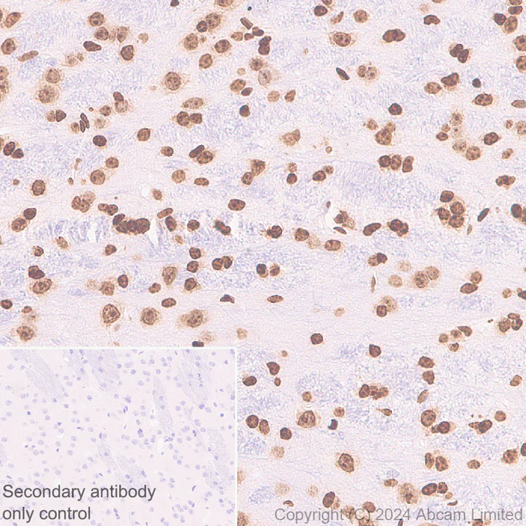 Immunohistochemistry (Formalin/PFA-fixed paraffin-embedded sections) - Anti-Histone H3 antibody [RM1288] - Nuclear Marker (AB322707)
