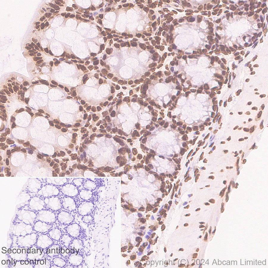 Immunohistochemistry (Formalin/PFA-fixed paraffin-embedded sections) - Anti-Histone H3 antibody [RM1288] (ab322707), expandable thumbnail