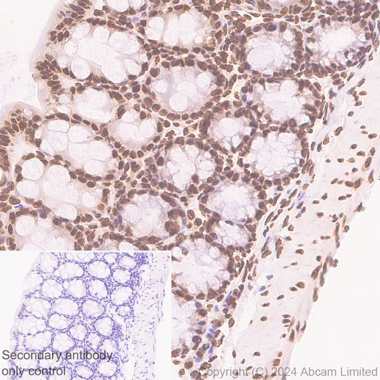 Immunohistochemistry (Formalin/PFA-fixed paraffin-embedded sections) - Anti-Histone H3 antibody [RM1288] - Nuclear Marker (AB322707)