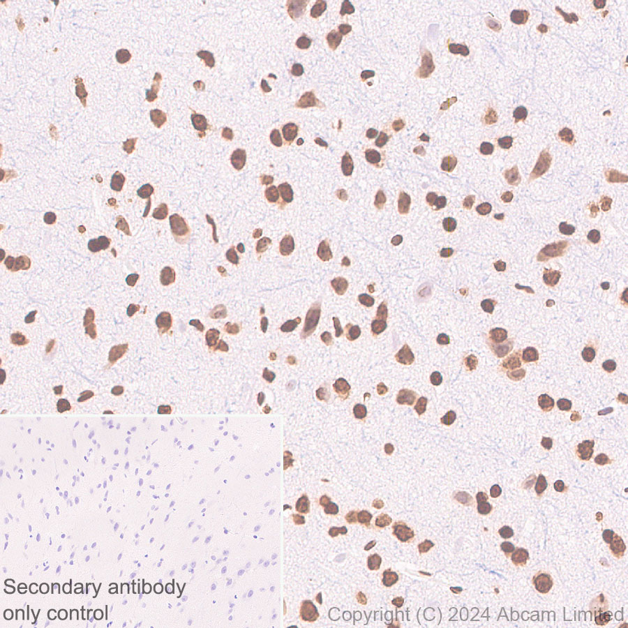 Immunohistochemistry (Formalin/PFA-fixed paraffin-embedded sections) - Anti-Histone H3 antibody [RM1288] (ab322707), expandable thumbnail