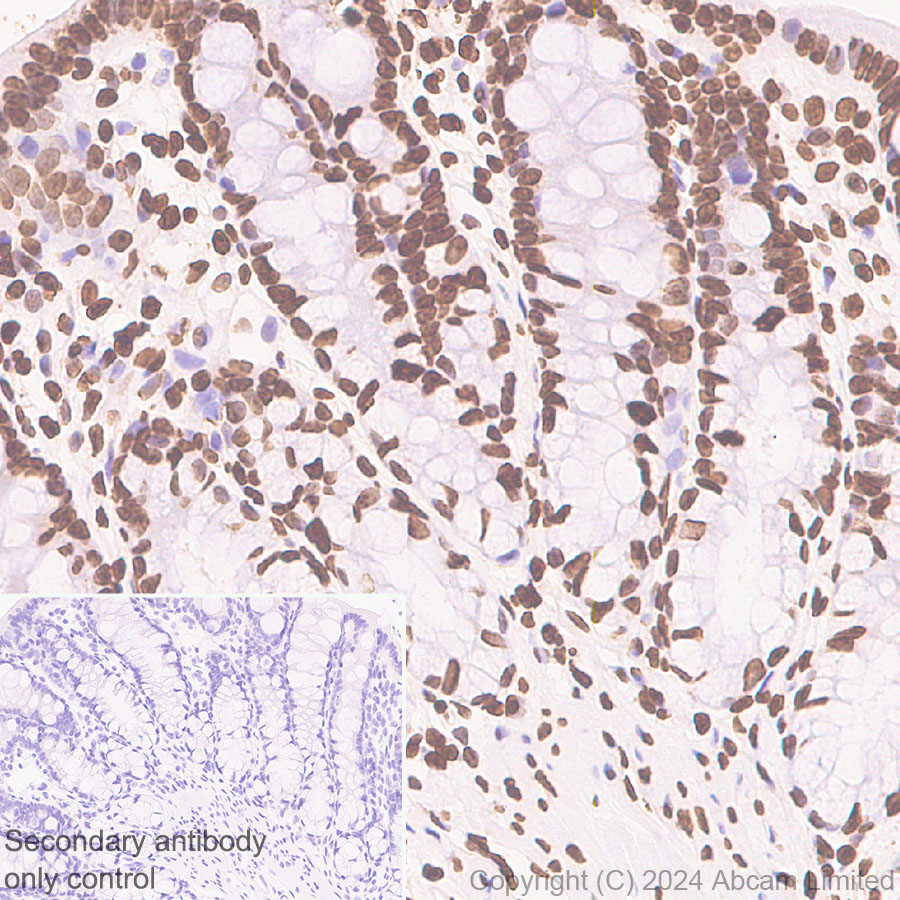 Immunohistochemistry (Formalin/PFA-fixed paraffin-embedded sections) - Anti-Histone H3 antibody [RM1288] (ab322707), expandable thumbnail