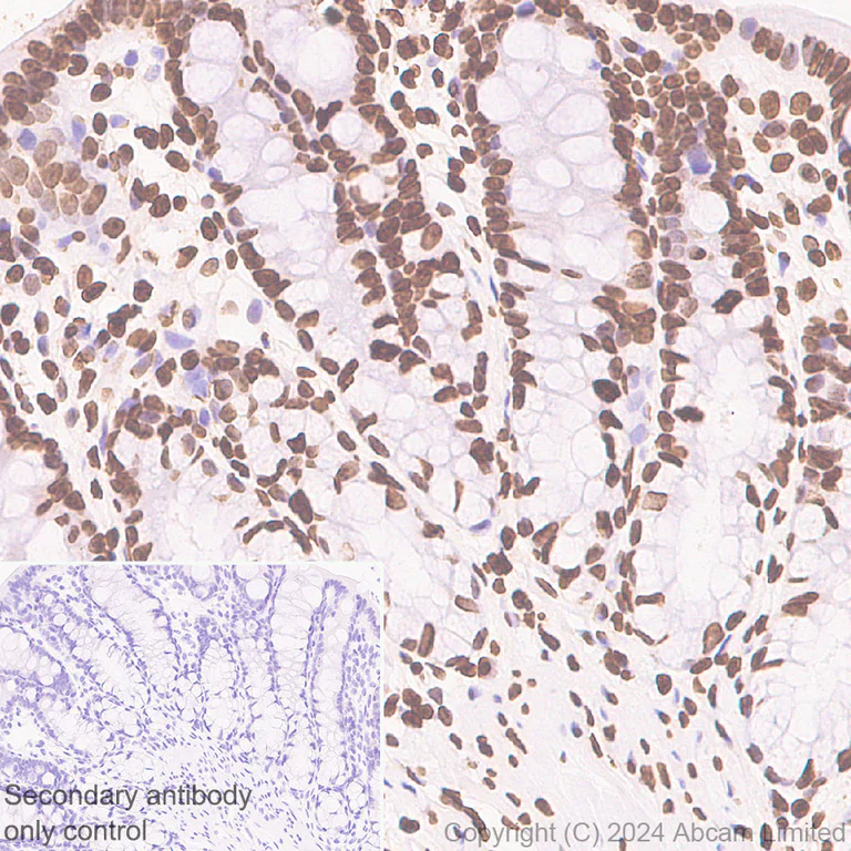 Immunohistochemistry (Formalin/PFA-fixed paraffin-embedded sections) - Anti-Histone H3 antibody [RM1288] - Nuclear Marker (AB322707)