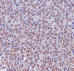 Immunohistochemistry (Formalin/PFA-fixed paraffin-embedded sections) - Anti-Histone H3 (asymmetric di methyl R17) antibody (AB8284)