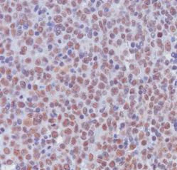 Immunohistochemistry (Formalin/PFA-fixed paraffin-embedded sections) - Anti-Histone H3 (asymmetric di methyl R17) antibody (AB8284)