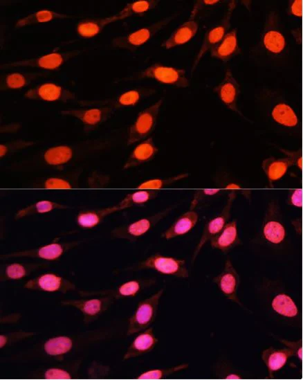 Immunocytochemistry/ Immunofluorescence - Anti-Histone H3 (asymmetric di methyl R2) antibody (AB194706)