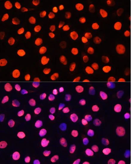 Immunocytochemistry/ Immunofluorescence - Anti-Histone H3 (asymmetric di methyl R2) antibody (AB194706)