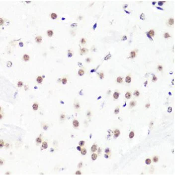 Immunohistochemistry (Formalin/PFA-fixed paraffin-embedded sections) - Anti-Histone H3 (asymmetric di methyl R2) antibody (AB194706)