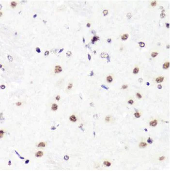 Immunohistochemistry (Formalin/PFA-fixed paraffin-embedded sections) - Anti-Histone H3 (asymmetric di methyl R2) antibody (AB194706)