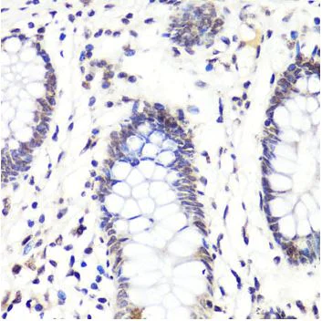 Immunohistochemistry (Formalin/PFA-fixed paraffin-embedded sections) - Anti-Histone H3 (asymmetric di methyl R2) antibody (AB194706)