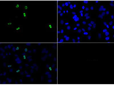 Immunocytochemistry/ Immunofluorescence - Anti-Histone H3 (asymmetric di methyl R2) antibody (AB272137)