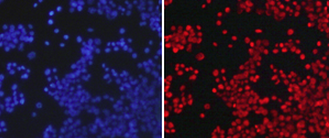 Immunocytochemistry/ Immunofluorescence - Anti-Histone H3 (asymmetric di methyl R26) antibody (AB194679)