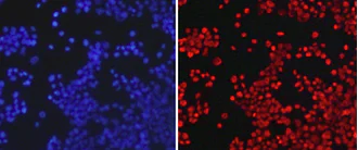 Immunocytochemistry/ Immunofluorescence - Anti-Histone H3 (asymmetric di methyl R26) antibody (AB194679)