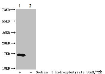 Western blot - Anti-Histone H3 (beta-hydroxybutyryl K23) antibody (AB241460), expandable thumbnail