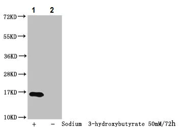 Western blot - Anti-Histone H3 (beta-hydroxybutyryl K23) antibody (AB241460)